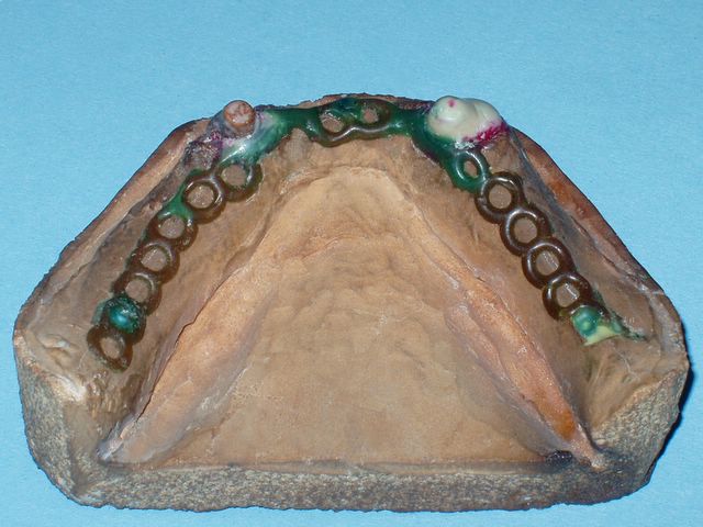 CEKA - REVAX 4